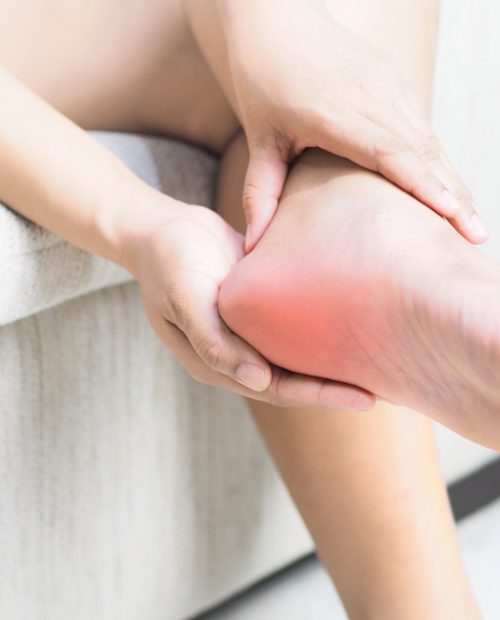 Heel,Pain,,,Tendon,Inflammation